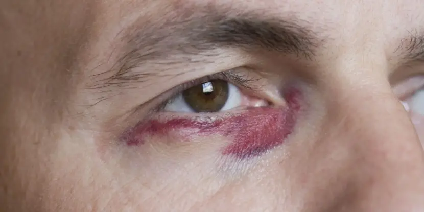 Двадцать наиболее опасных факторов для здоровья глаз: обзор Американской академии офтальмологии