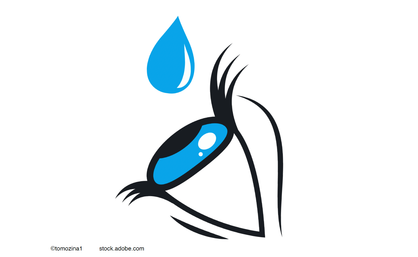 Точка зрения врача: глазные капли при глаукоме останутся с нами надолго