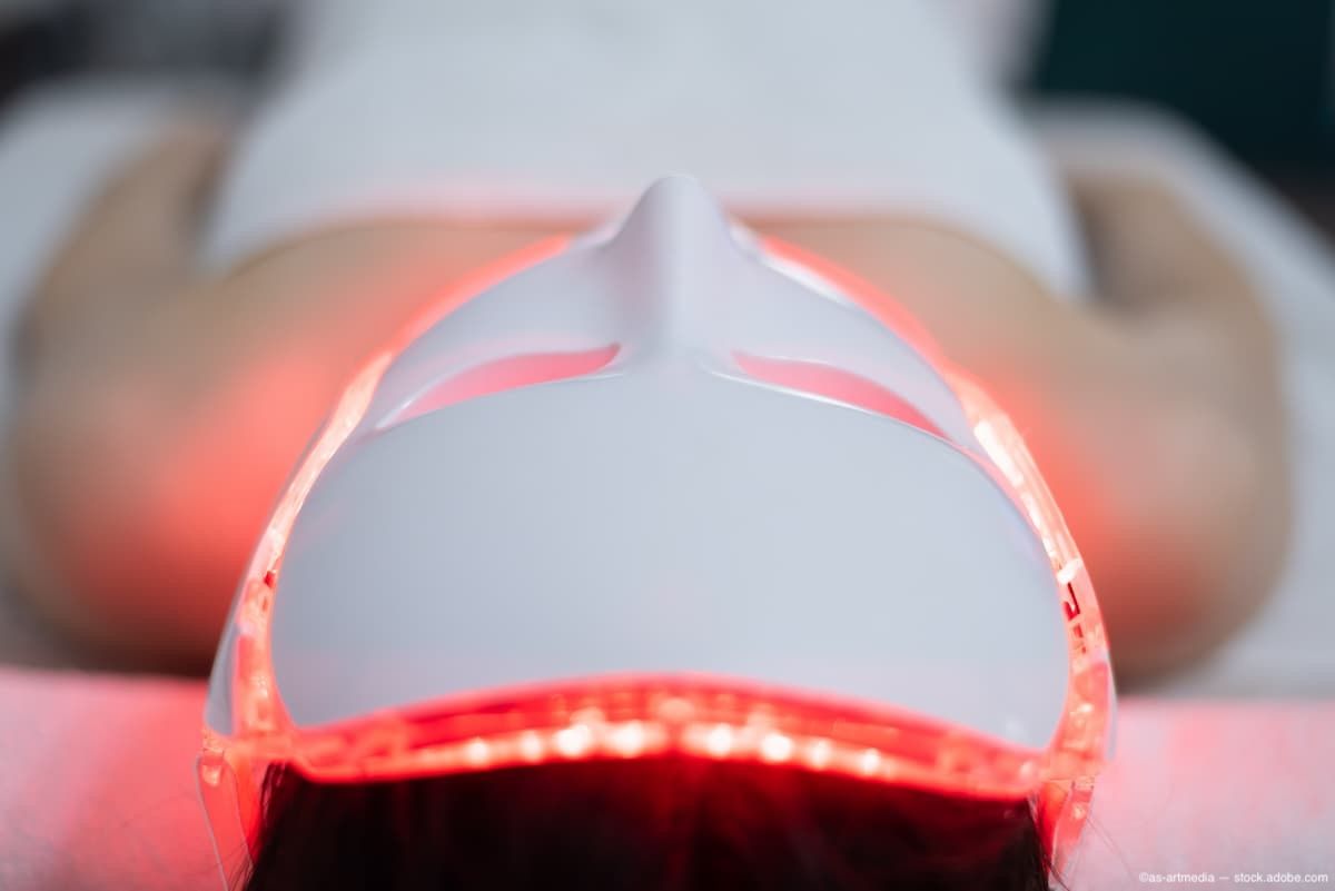 Неинвазивная LED-светотерапия демонстрирует долгосрочную безопасность при клиническом наблюдении пациентов с начальной катарактой