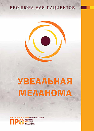 Информационная брошюра для пациентов с диагнозом увеальная меланома
