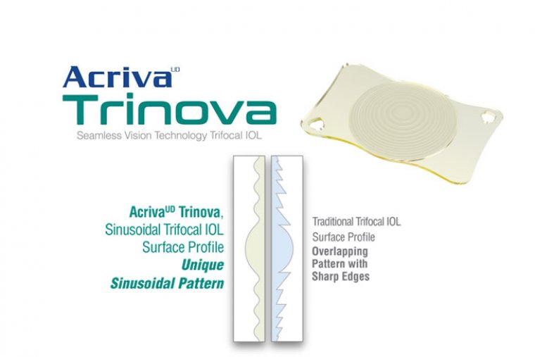 Синусоидальная оптика трифокальных ИОЛ: обзор технологии AcrivaUD Trinova
