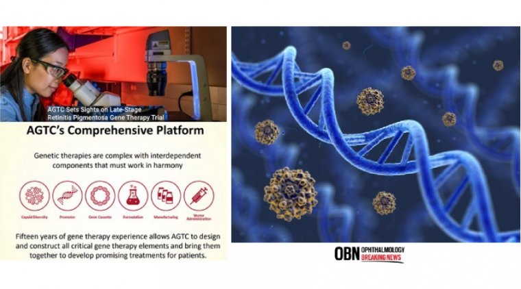 Терапия AGTC-501 улучшает зрение при Х-сцепленном пигментном ретините
