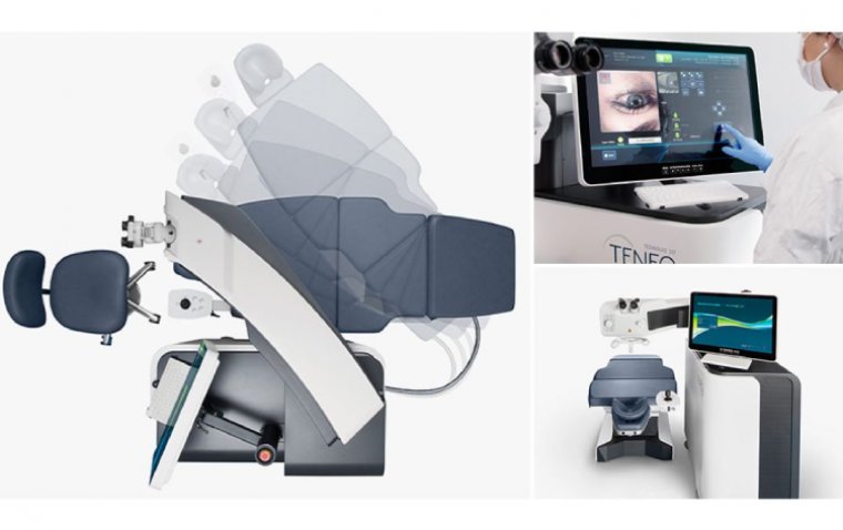 FDA одобрила эксимерную лазерную платформу Teneo производства Bausch + Lomb