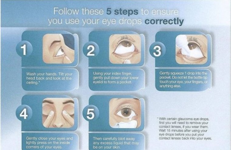 Комбинированные офтальмологические капли в терапии глаукомы: преимущества и клиническая эффективность