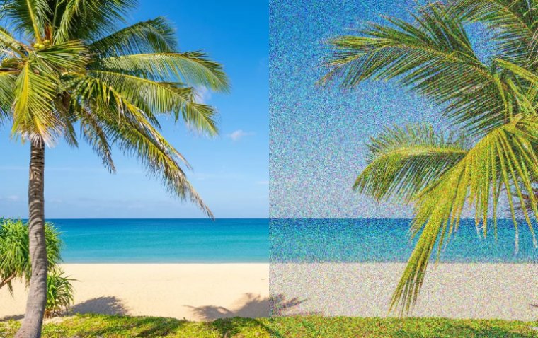 МРТ-исследование выявило роль глутамата и серотонина при синдроме зрительного снега