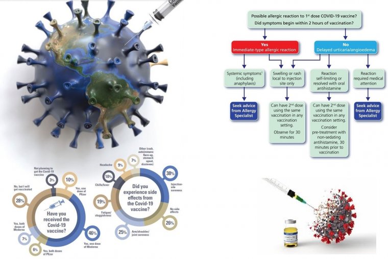 Влияние вакцинации от COVID-19 на органы зрения: анализ побочных эффектов и профессиональных позиций офтальмологов