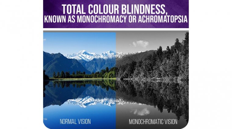 Ахроматопсия: клиническая картина, диагностика и современные подходы к ведению пациентов