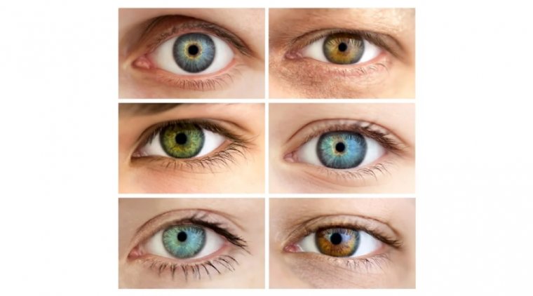 Возможно ли изменить цвет радужки? Анализ офтальмологических факторов пигментации