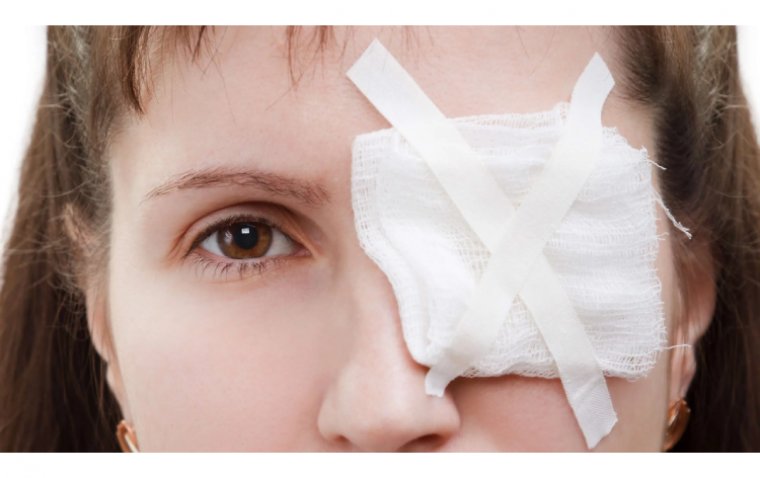 Лечение травматических повреждений глаз: методы и рекомендации