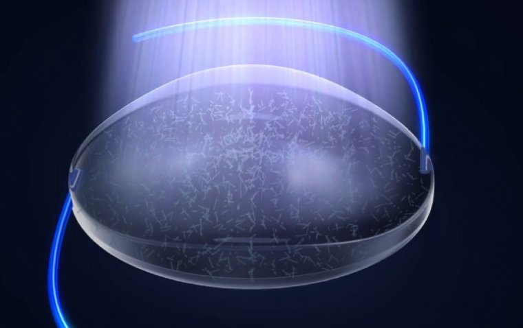 Анализ преимуществ и ограничений технологии светорегулируемых интраокулярных линз (Light Adjustable Lens, LAL)