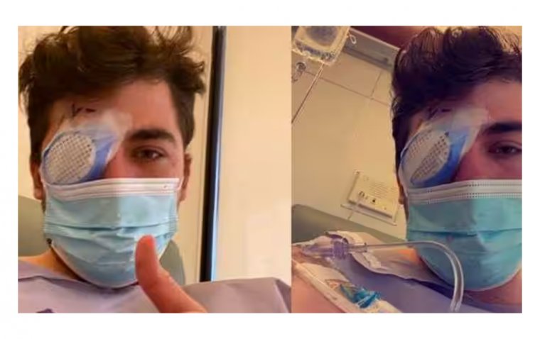 Редкий плотоядный паразит стал причиной потери зрения у молодого человека после сна в контактных линзах