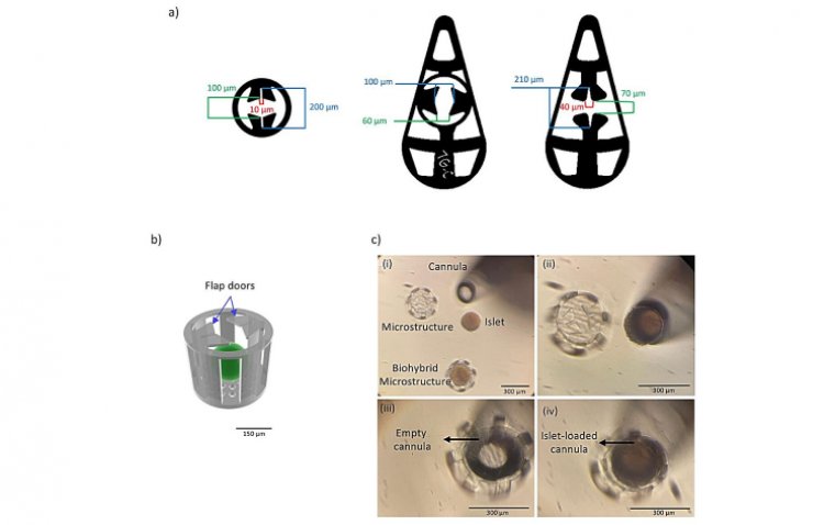 Микроимплантат для передней камеры глаза: новая платформа для клеточной терапии диабета