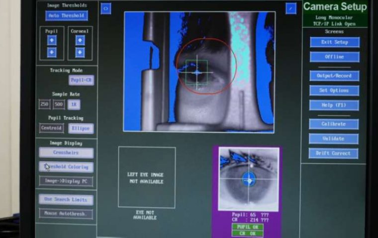 Выявлена диссоциация зрачкового ответа у пациентов с депрессией