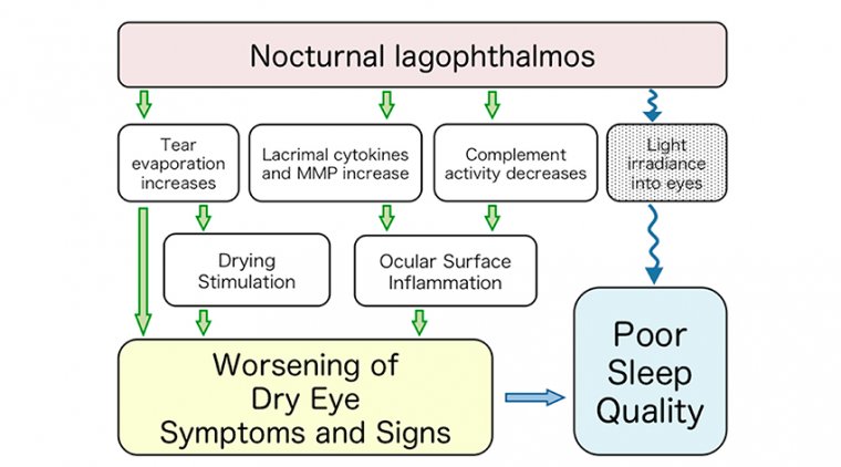 Этиология ночного лагофтальма: обзор клинических подходов