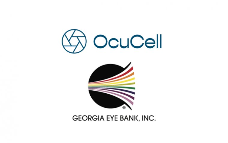 OcuCell привлек финансирование от Georgia Eye Bank