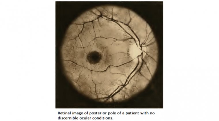 Эволюция офтальмологической визуализации: от первых снимков сетчатки до цифровых технологий