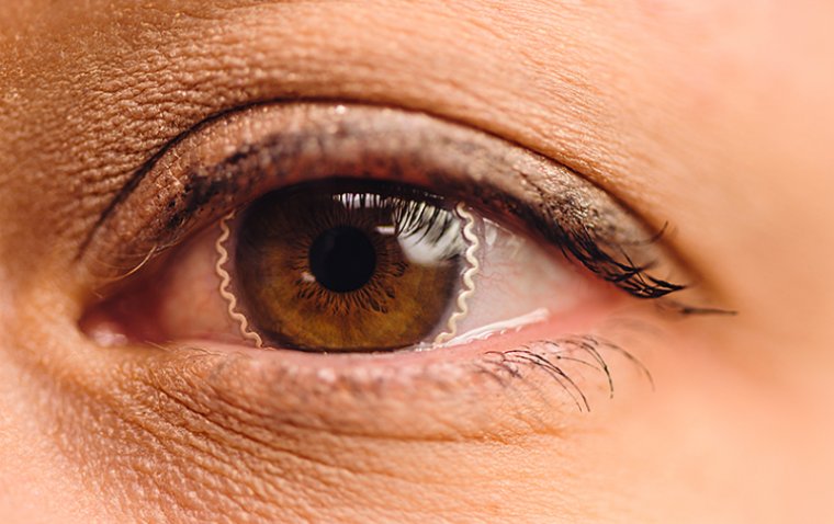 Грант NIH в размере 6,7 млн долларов направят на создание «умных» контактных линз инженерами Purdue