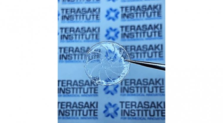 Разработана контактная линза для профилактики синдрома сухого глаза, вызванного ношением контактных линз