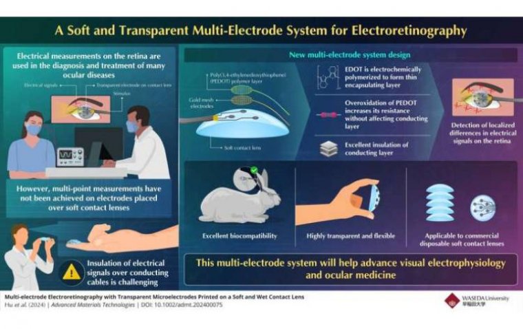 Разработана мягкая контактная линза для точного мониторинга состояния сетчатки