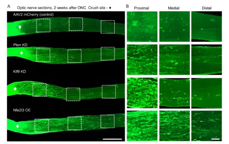 Белок Nfe3 стимулирует регенерацию зрительного нерва: данные доклинического исследования