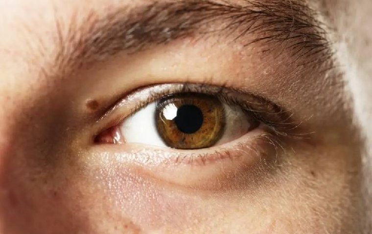 Выявлены генетические мишени для терапии косоглазия