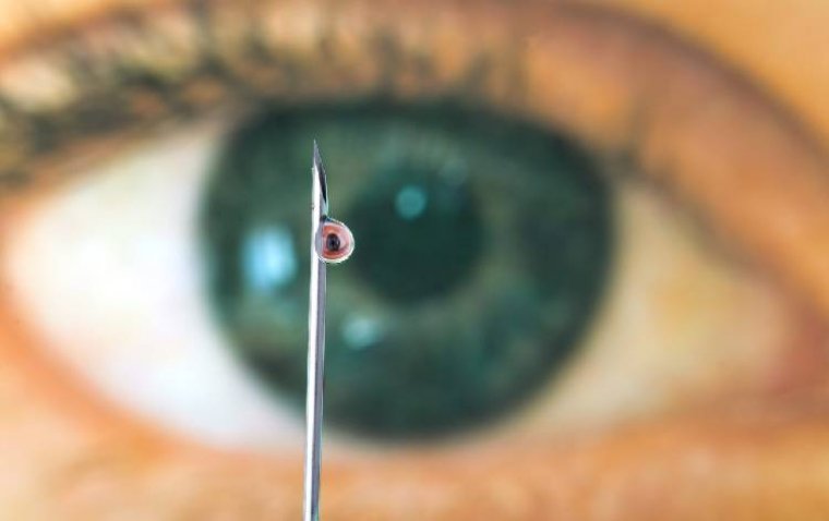 Анализ влияния Pegcetacoplan на прогрессирование географической атрофии сетчатки