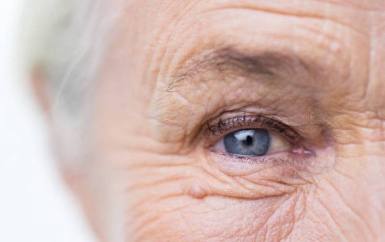 Роботизированная радиотерапия снижает частоту инъекций при неоваскулярной возрастной макулярной дегенерации