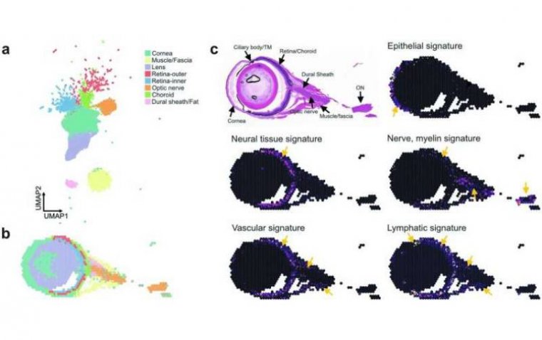 Иммунный щит глаза: открыт новый путь защиты от инфекций головного мозга