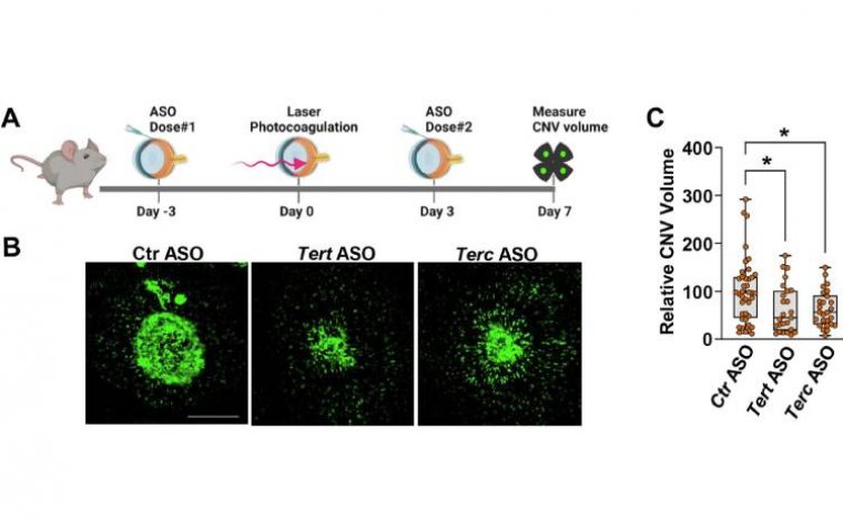 Экспериментальная терапия влажной формы ВМД: ингибирование теломеразы как альтернативный подход