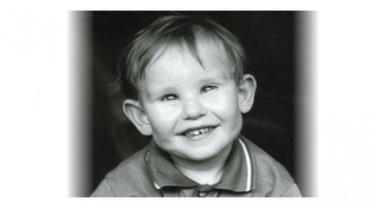 Синдром Лоу: редкое генетическое заболевание с офтальмологическими проявлениями