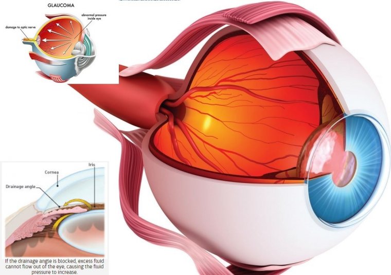 Разблокировка путей оттока внутриглазной жидкости при глаукоме: новый взгляд на патогенез