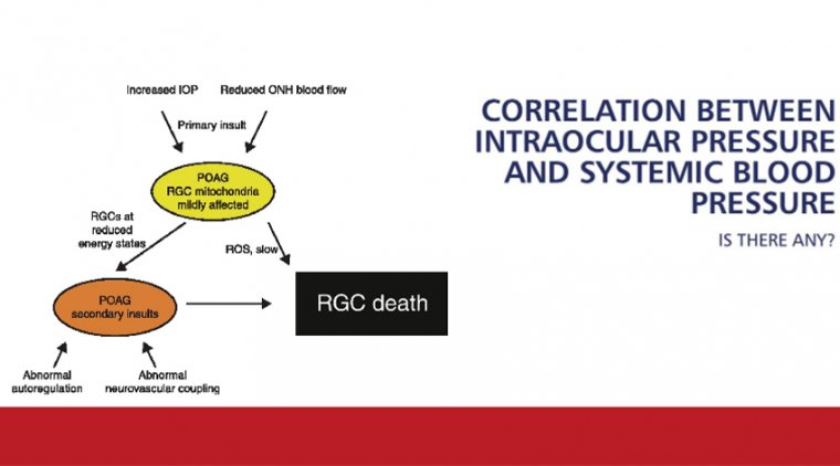 Взаимосвязь артериального давления и внутриглазного давления как фактор риска глаукомы
