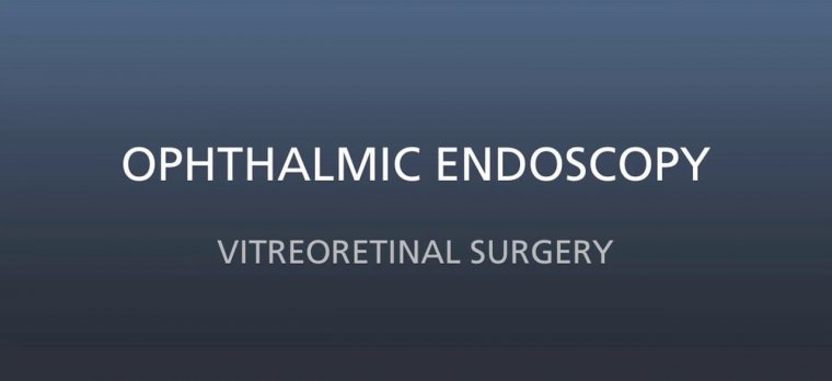 Эндоскопия в офтальмологии: современное применение и перспективы метода