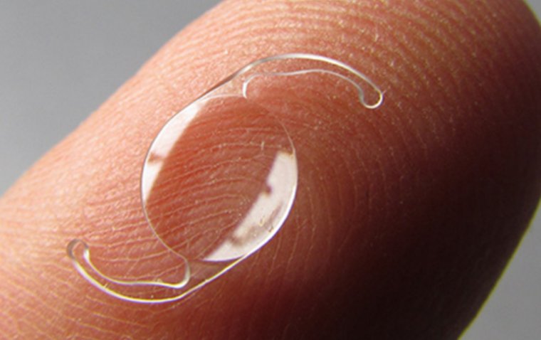 Роль замены интраокулярной линзы в оптимизации зрительной четкости