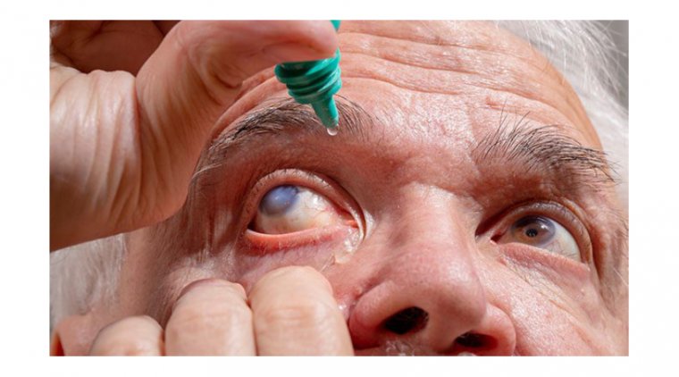 «Немой похититель зрения»: что такое глаукома и как она меняет жизнь пациента