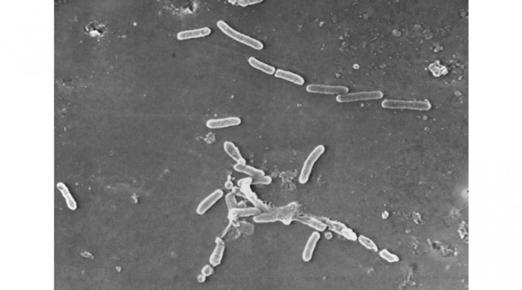 Реклама глазных капель привела к распространению контагиозной бактериальной инфекции: данные CDC