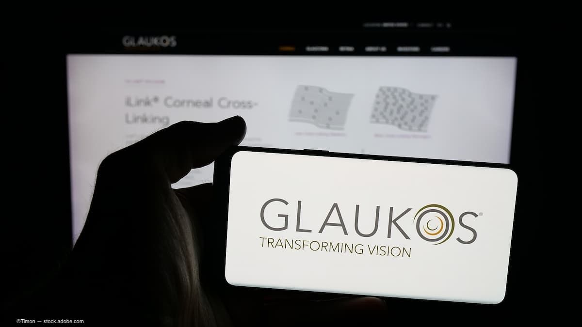 Glaukos объявляет о коммерческой доступности Epioxa для лечения кератоконуса