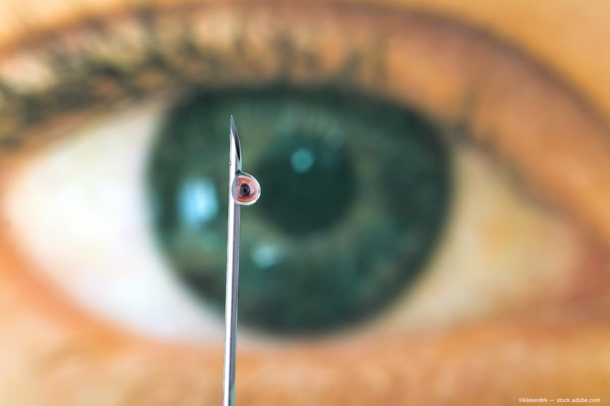 SparingVision завершила дозирование пациентов в исследовании PRODYGY с SPVN06
