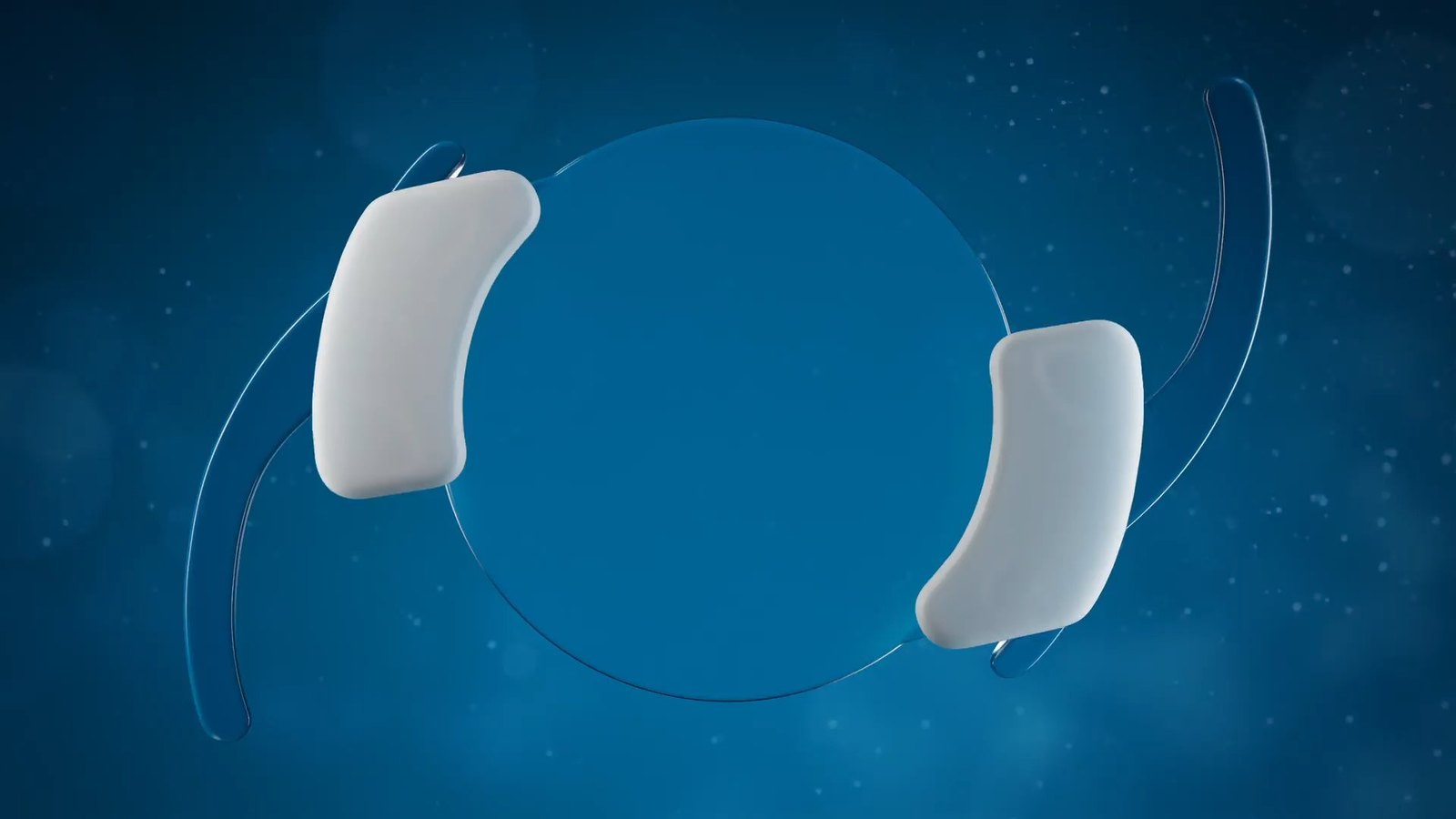SpyGlass Pharma приобрела Advanced Vision Science для развития технологии лекарственно-элюирующих ИОЛ при глаукоме