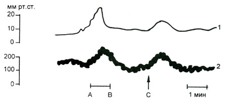 Волков - Рис.6. Кривые из опытов на кошках M. Brock et al., 1972