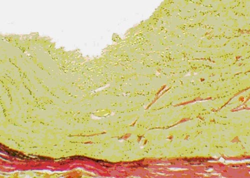 Интактные кролики. Толщина слоя аксонов ганглиозных клеток сетчатки у диска зрительного нерва. Окраска гематоксилином и эозином.  Ув.  200
