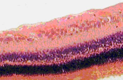 Экспериментальная глаукома, леченная препаратом эрисод. Выраженное нейропротекторное воздействие на сетчатку кролика. Окраска гематоксилином и эозином. Ув.  200